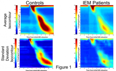 Ineffective Esophageal Motility Isocontour Analysis – Manometry Databank